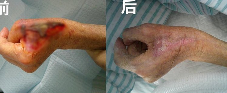 白条套取现金最佳方法pos机