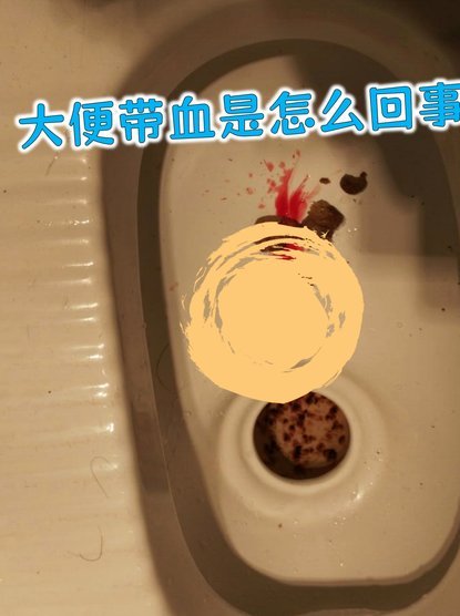 白条带血，潜在危险为何出现？